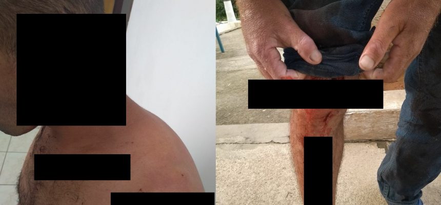 26638350_1780855195293008_1952519452_n