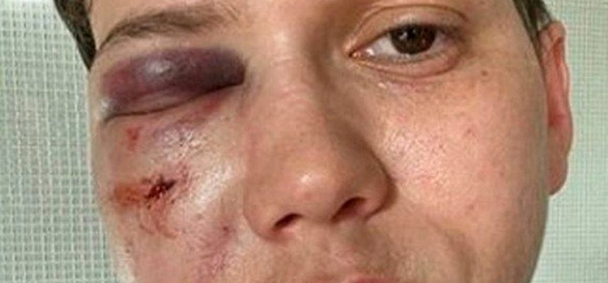 csm_karol_eller_agressao_ataque_homofobico_foto_reproducao_f23203e8bd