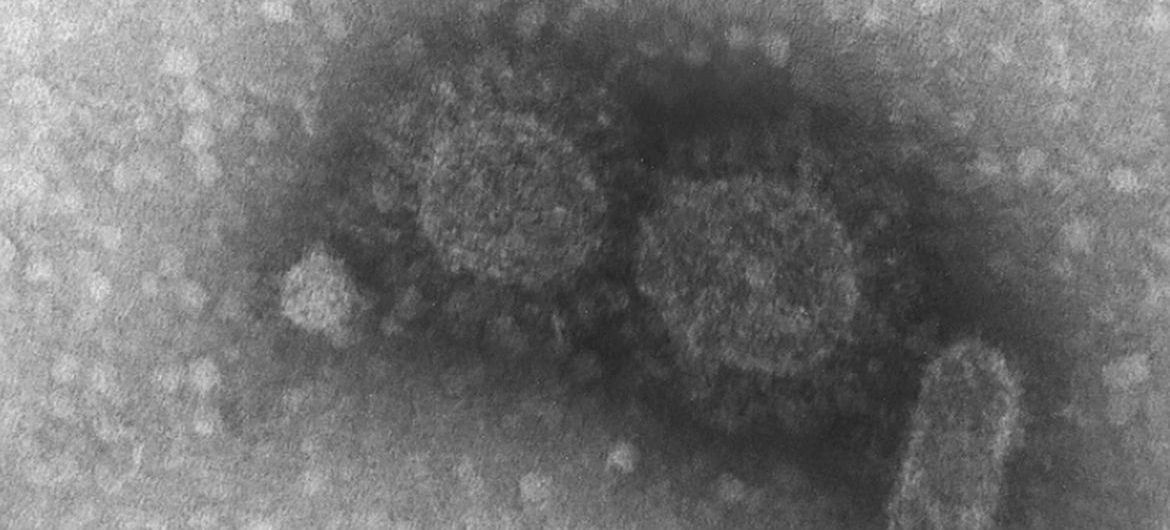 Divulgada sequência genética de vírus dois dias depois de surgir o primeiro caso no Brasil. Artigos científicos são publicados com rapidez em todo o mundo (foto: Instituto Adolfo Lutz)Divulgada sequência genética de vírus dois dias depois de surgir o primeiro caso no Brasil. Artigos científicos são publicados com rapidez em todo o mundo (foto: Instituto Adolfo Lutz)