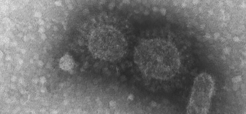 Divulgada sequência genética de vírus dois dias depois de surgir o primeiro caso no Brasil. Artigos científicos são publicados com rapidez em todo o mundo (foto: Instituto Adolfo Lutz)Divulgada sequência genética de vírus dois dias depois de surgir o primeiro caso no Brasil. Artigos científicos são publicados com rapidez em todo o mundo (foto: Instituto Adolfo Lutz)