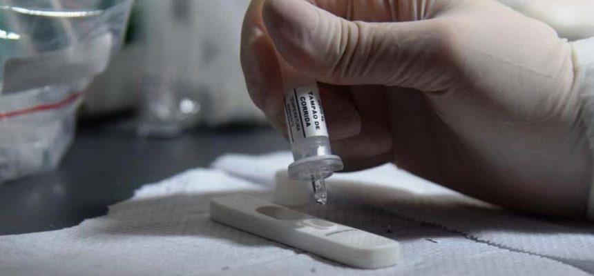 testagem-em-massa-aluminio