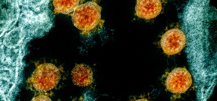 IRF - Frederick
2/25/2020
09:15
110000
8.0
80
Imaging
#2020-04-A
2019-n-COV (CCL81 Cells)





XpixCal=3.848812
YpixCal=3.848812
Unit=nm
##fv3
4096
3008
7.0.1.147
Blank1
Blank2
##fv4