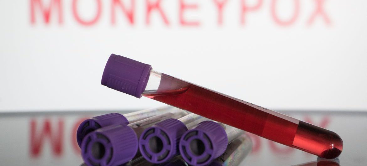 2022-06-18t000000z_168655654_mt1nurpho000kmrsbn_rtrmadp_3_monkeypox