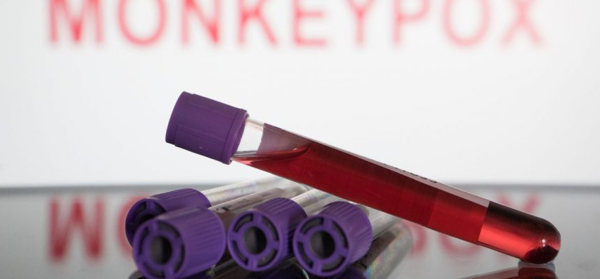 2022-06-18t000000z_168655654_mt1nurpho000kmrsbn_rtrmadp_3_monkeypox