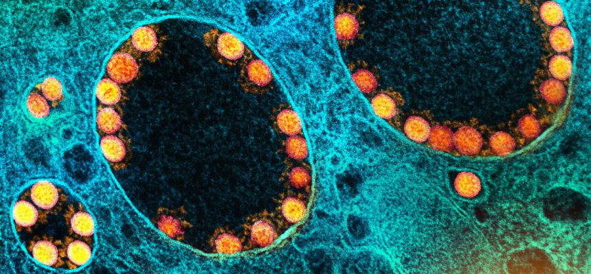 AMT Camera System
7/7/2021
11:50
0.30
8.0
80
Diffraction
#2021-16-1H (B1)
#H1103 Nasal Turbinate





XpixCal=NaN
YpixCal=NaN
Unit=A
##fv3
4096
3008
7.0.1.147
Blank1
Blank2
##fv4