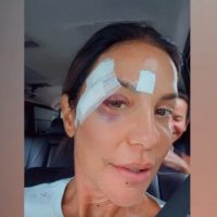 178634apos-sofrer-desmaio-ivete-sangalo-recebe-alta-e-revela-diagnostico-medico-3