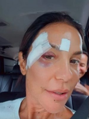 178634apos-sofrer-desmaio-ivete-sangalo-recebe-alta-e-revela-diagnostico-medico-3