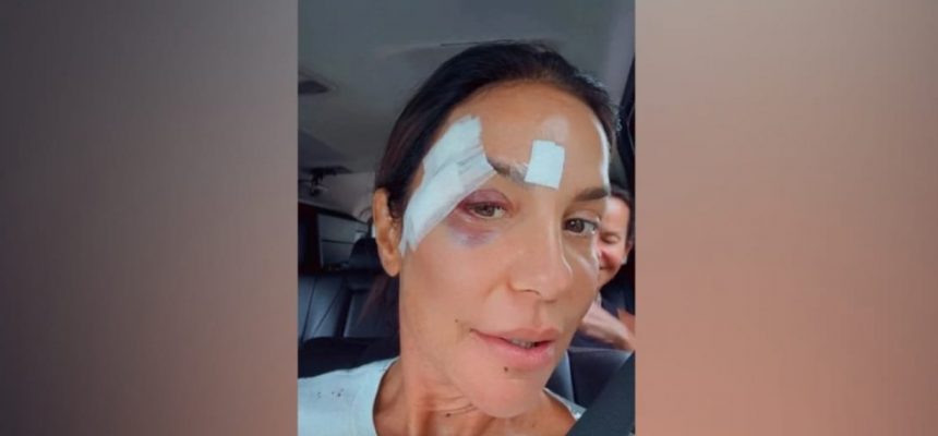 178634apos-sofrer-desmaio-ivete-sangalo-recebe-alta-e-revela-diagnostico-medico-3